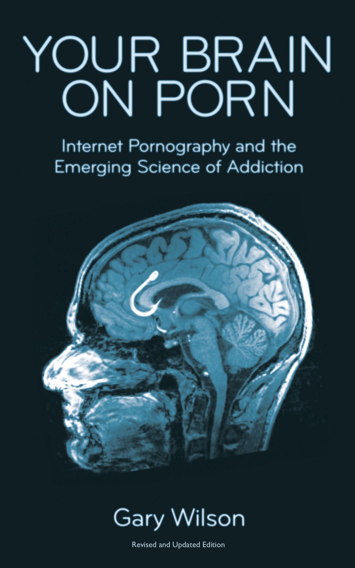 Your Brain On Porn By Gary Wilson